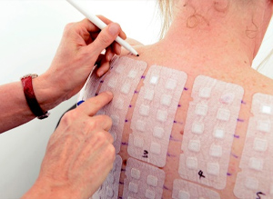 Module 6: Preparing Patch Tests